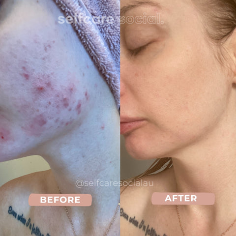 Youthful Glow Duo - LED Mask & Hydrating Eye Masks