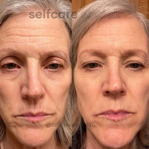 Youthful Glow Duo - LED Mask & Hydrating Eye Masks