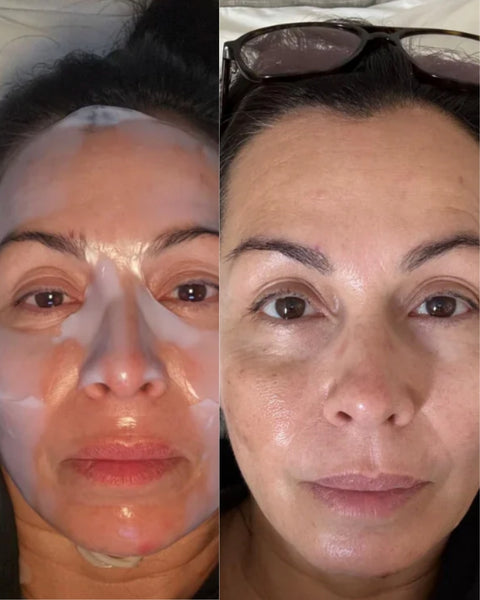 Bio-Collagen Hydrating Face Masks - 4 pack