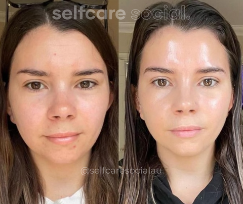 Bio-Collagen Hydrating Face Masks - 4 pack