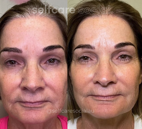 Bio-Collagen Hydrating Face Masks - 4 pack