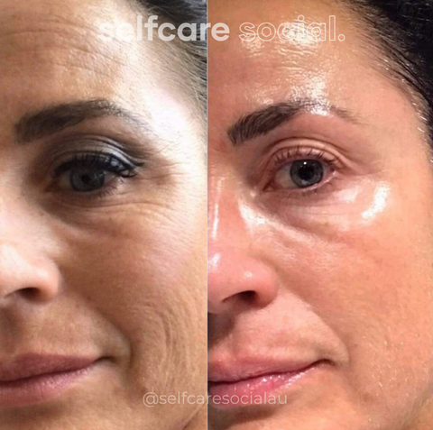 Bio-Collagen Hydrating Face Masks - 4 pack