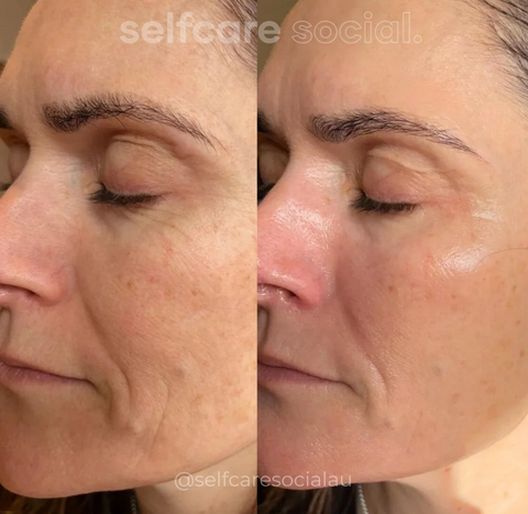 Bio-Collagen Hydrating Face Masks - 4 pack