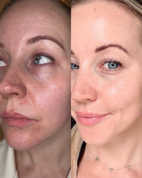 Face & Neck Tech Duo - LED Mask & GlowLift Wand Face and Neck Device