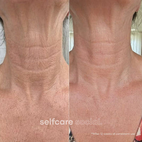Face & Neck Tech Duo - LED Mask & GlowLift Wand Face and Neck Device