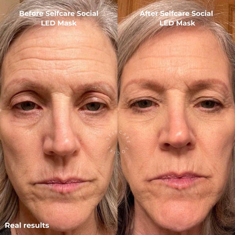 Luxe Glow Trio – LED Mask + Eye & Collagen Masks