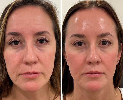 Bio-Collagen Hydrating Face Masks - 4 pack