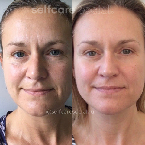 Radiance Glow Duo - LED Mask & Collagen Face Masks