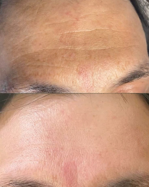 Face & Neck Tech Duo - LED Mask & GlowLift Wand Face and Neck Device