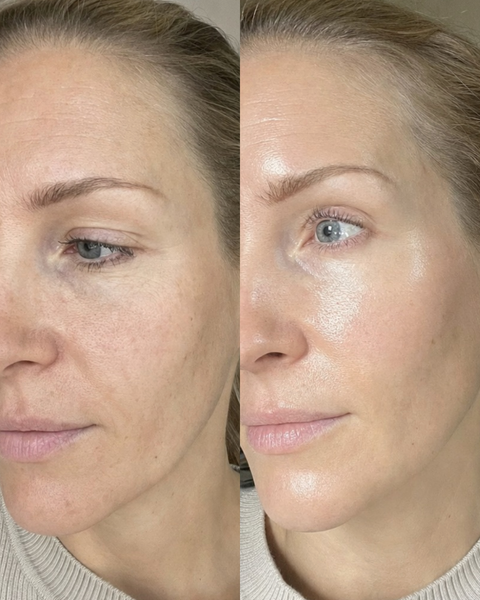Face & Neck Tech Duo - LED Mask & GlowLift Wand Face and Neck Device