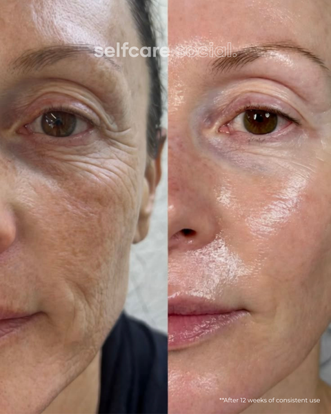 GlowLift Wand Face and Neck Pro LED Device